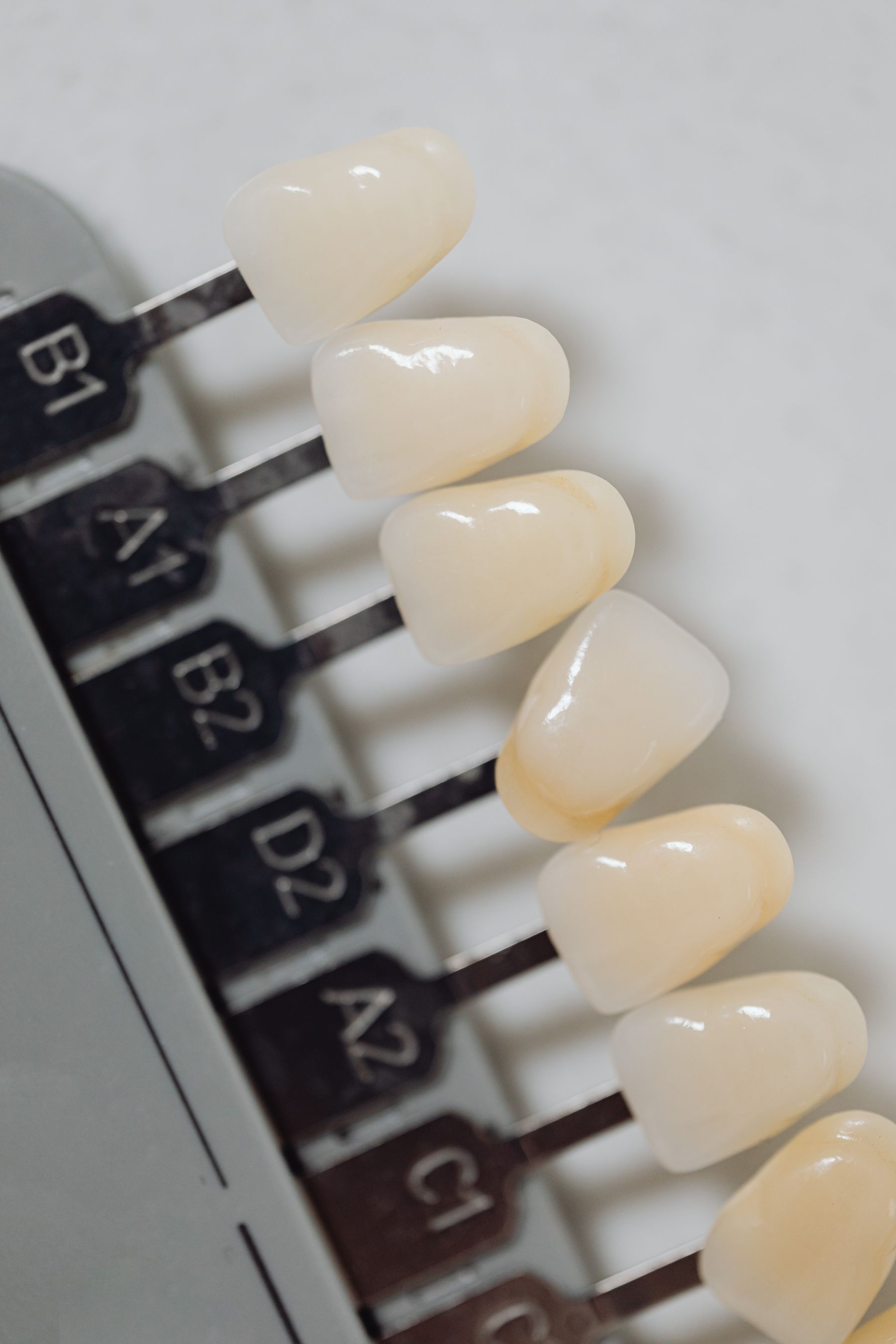Primer plano editorial de una guía de tonos dentales